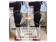 ヨサパーク ツムギ(YOSA PARK)/ビフォー＆アフター