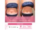 ビーグレイス(Vigrace)の写真
