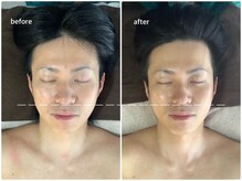 アベリア リュウ(Aberia Lieu)/頭蓋小顔矯正/小顔矯正