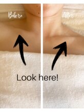 エン(YEN)/デコルテ・肩こりケア