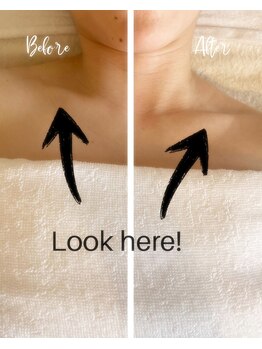 エン(YEN)/デコルテ・肩こりケア