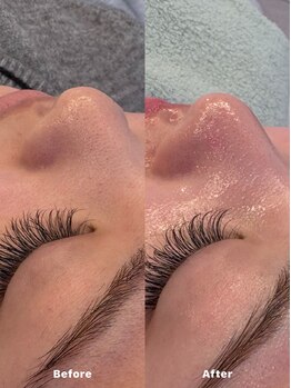 クラルテアンドコー(Salon Clarte&Co.)/NUCLAIREフェイシャルワックス