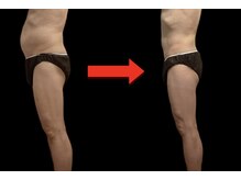 トゥルーボーン(true born)/とにかくお腹を変えたいならこれ