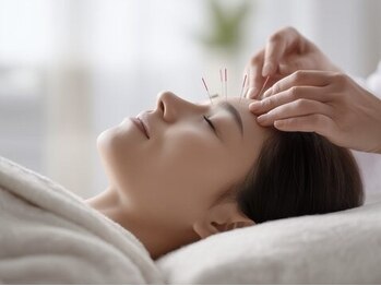 風凪の写真/鍼による【頭痛専門コース】は緊張型・片側がズキズキするetc.頭痛の種類に合わせてオーダーメイド施術＊