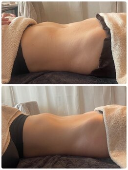 ティエルプラス(tiele+)/骨盤調整×HOT腸もみ