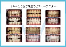 ホワイトニングショップ あおもり新町店