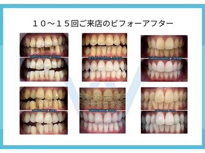 ホワイトニングショップ あおもり新町店の写真