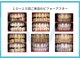 ホワイトニングショップ あおもり新町店の写真