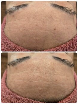 クレビア(CREBIA)/【シミ・シミケア専門店】沖縄県