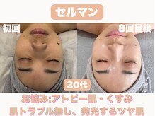 ナーナモエ(na-namoe)の雰囲気（インスタで話題の韓国肌管理セルマンで触れたくなるような水光肌）