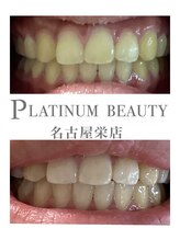 プラチナムビューティー 名古屋栄本店(PLATINUM BEAUTY)/お客様Before After