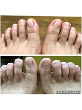 ウォーク(Walk)/【爪溝の徹底掃除】