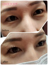 アイクル 伊勢崎店(ikuru)/忙しい毎日でもエクステで快適♪