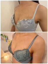 美人バスト 新宿店/☆姉妹店バストアップ症例写真☆