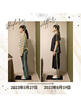 ラクリエ 東加古川院(La Creer)/お客様ビフォーアフター