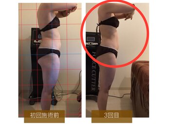 サロンドボーテ ヴィクトワール マルヤマ(Salon de beaute VICTOIRE MARUYAMA)/フォースカッター【w1ペース】