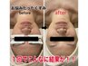 【2種類光照射】手強い年齢サインに速攻小顔&美肌ルナ光スペシャルコース