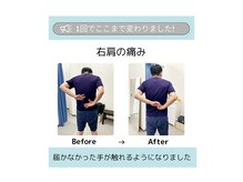 ケアフルはりきゅう施術院/Before→After