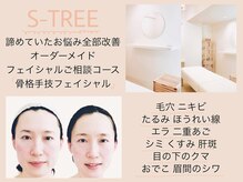 エスツリービューティーアンドネイル(S-TREE BEAUTY&NAIL)