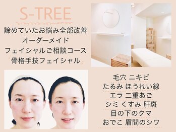 エスツリービューティーアンドネイル(S-TREE BEAUTY&NAIL)