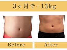 ヨサパーク トゥインクル(YOSAPARK twinkle)