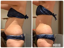 ビーグレイス(Vigrace)/ハイパーナイフEX /シェイプ