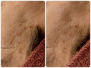 クレビア(CREBIA)/【シミ・シミケア専門店】沖縄県