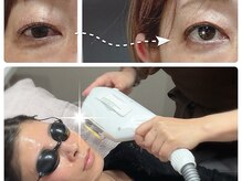 さりぃず ねぃる(SALLY’S NAIL)の雰囲気(目もパッチリするほどの復元力はTHRひかりフェイシャル&脱毛も◎)