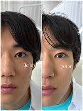 トイロアイサロン(toiro eyesalon)/メンズまつパで視界スッキリ♪