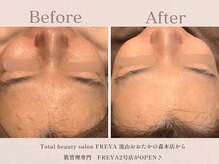 フレイヤ 門前仲町店(FREYA)