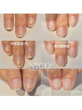 ニコプラス(NICO+)/自爪育成パラジェルクリア補強
