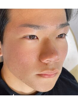 アイブロウマン(i Browman)/施術イメージ