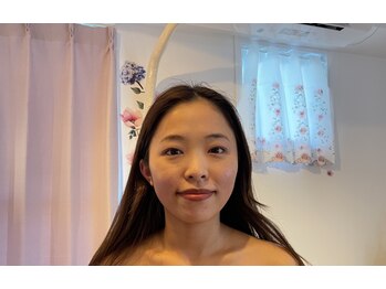 クラルスシンメトリーサロン 高槻店(Clarus Symmetry Salon)/小顔特化コース