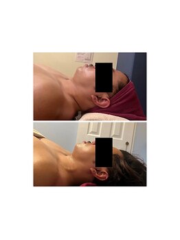 ルナグランデ 心斎橋店(Luna grande.)/男性にも大人気のメニュー