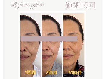 パルタージュ(Partage)/オーダーメイドプログラム★