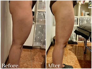 サロンドフェイス(Salon de Faith)/【ラジオ波】3回施術♪