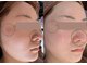 アイビ(愛美)の写真