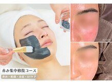 スリースリー(THREE THREE)の雰囲気（【原因別赤みケア】敏感な肌を修復、本来の肌機能を改善）