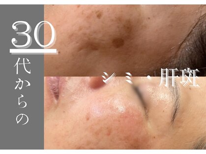 モアナ(Moana)の写真