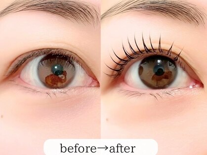 グラルト(GLALT)の写真