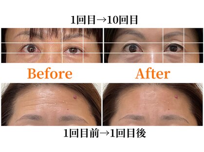 シルエラバレ(CiruelaValle)の写真