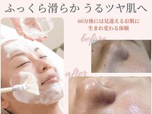 フロムエスティ 日本橋人形町店(FROM-ST)の雰囲気（60分後には気になる毛穴詰まり＆黒ずみが無くなりツルツル肌へ！）
