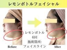 フェアリー 小松店の雰囲気（お悩み解消に向け全力サポート♪集中施術/小顔/レモンボトル）