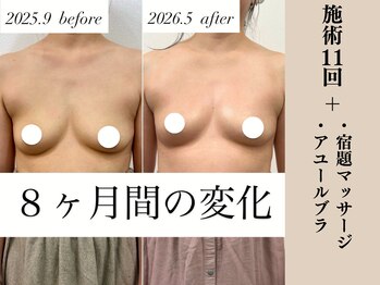 ソワ(soie)/出産・重力にも負けないバスト