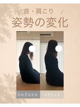 アオ 香椎(AO)/before→after