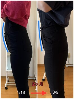 クルミ(Kurumi)/産後ケアの効果