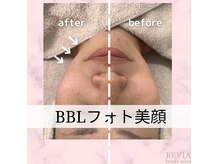 レヴィア(REVIA)の雰囲気（エニシー正規取扱店☆フェイシャル施術にも使用）