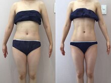 ビラ 銀座店(BILA)/キャビラジ