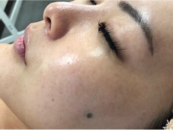 エコム(ECOM)の写真/毛穴の悩み、今日からリセット！ファンデで隠すより、毛穴ケアで魅せる肌へ。お気軽にご相談ください☆