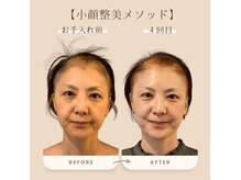 サロンマニア(SALON MANIA)の雰囲気（年齢関わらず老け顔脱出！フェイスラインもスッキリ！たるみケア）